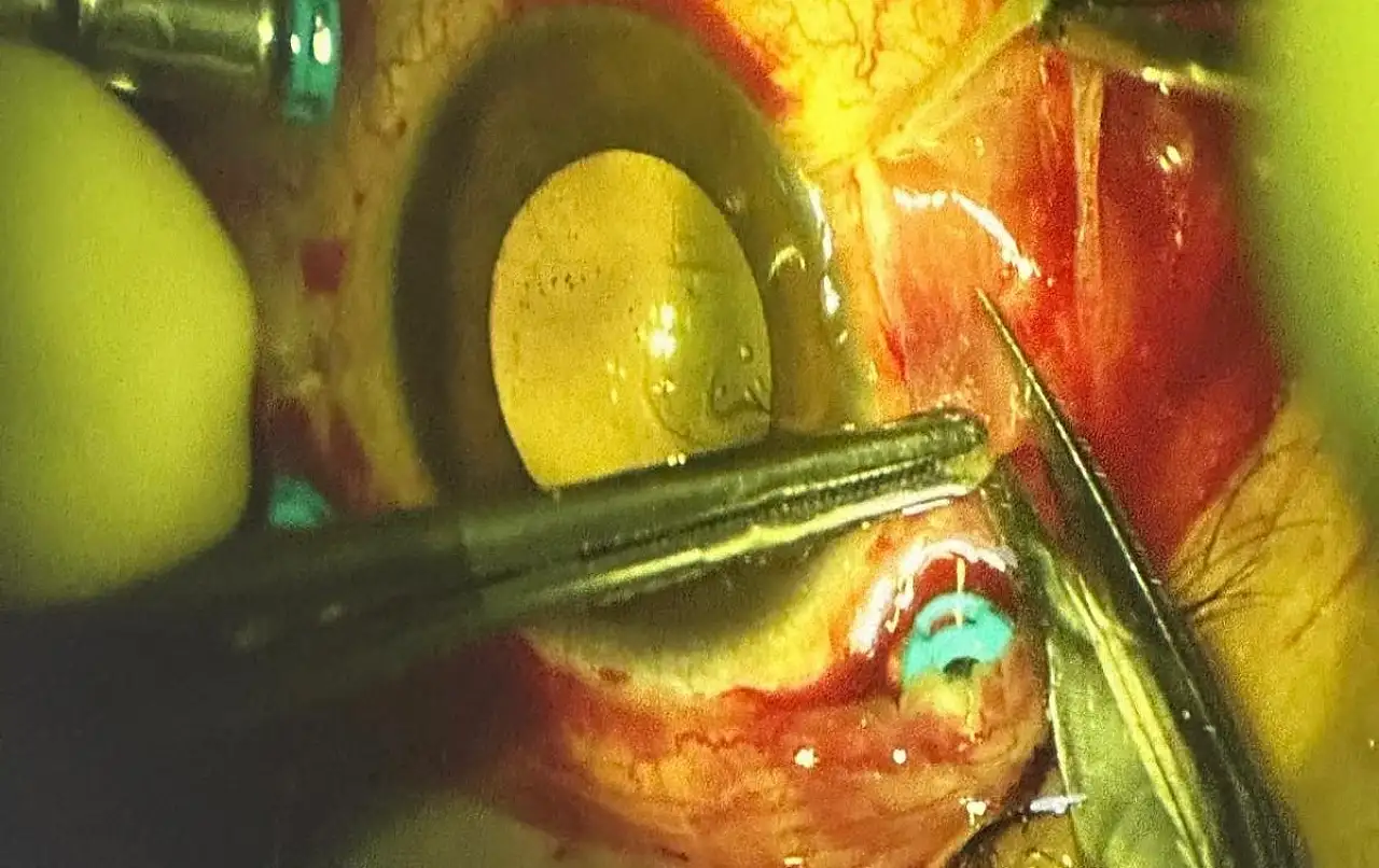 Kayınpederi tarafından gözünden vurulan damat Kayseri'ye sevk edildi!