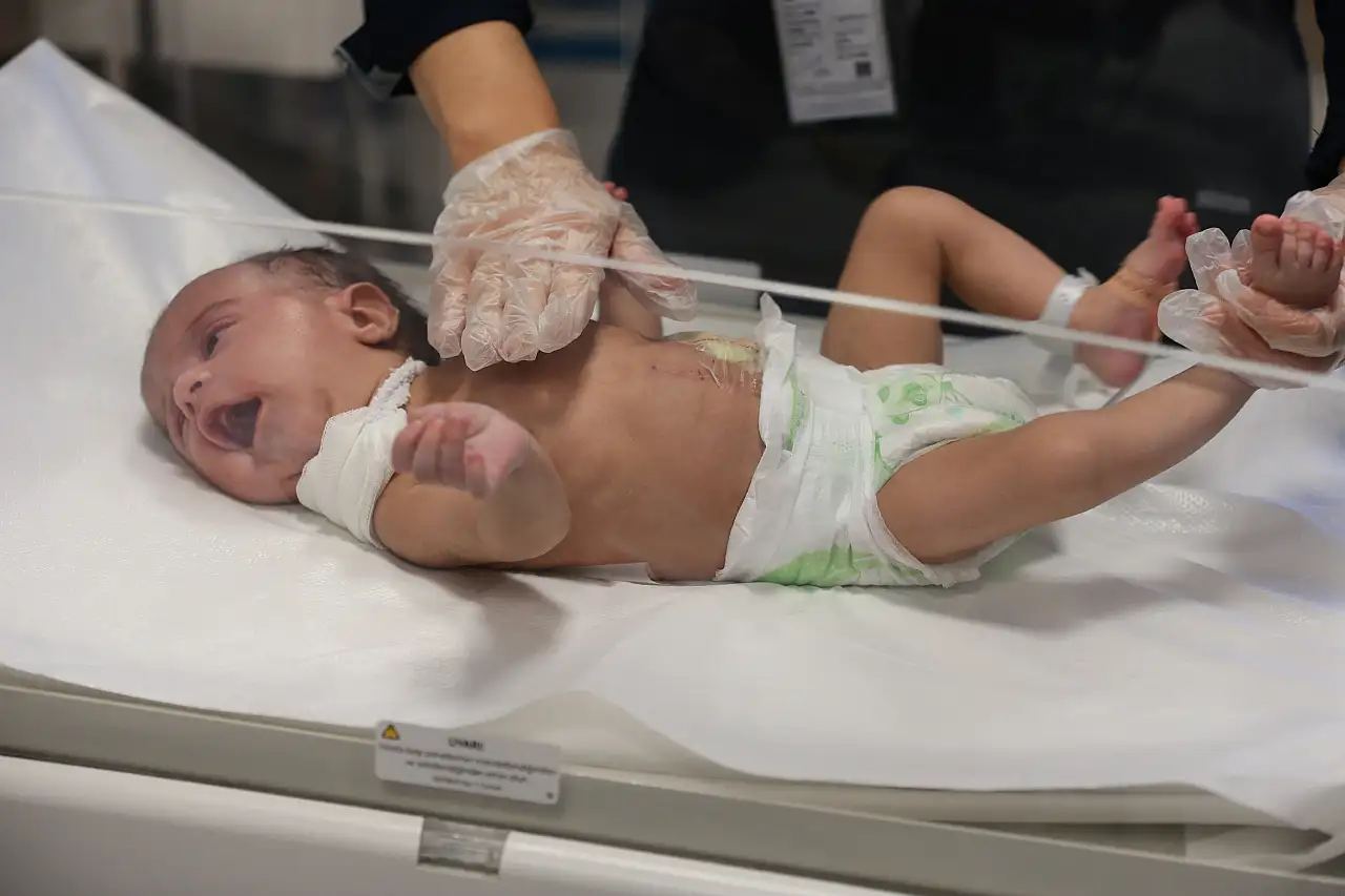 Kayseri Şehir Hastanesinde yapay yemek borusu yapılacak