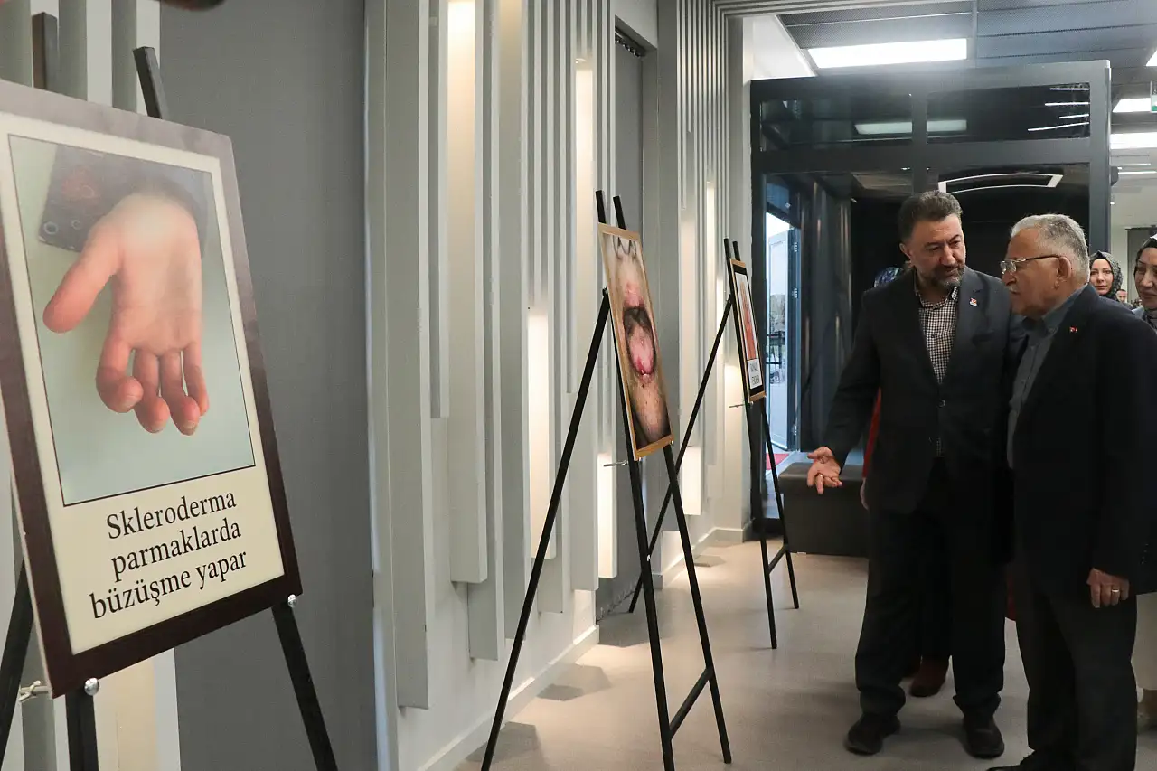 ERÜ'den yapay zeka destekli romatizma sergisi