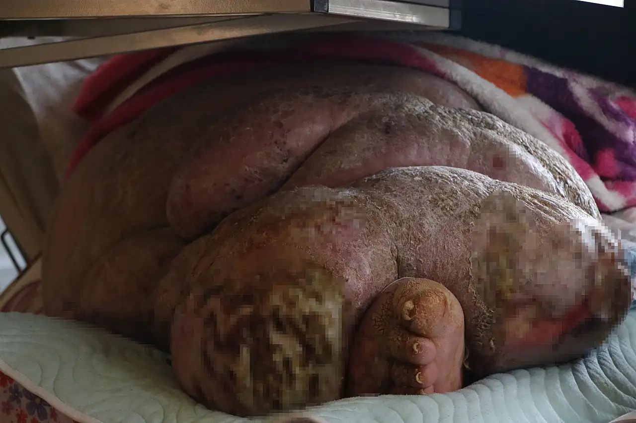 kayseri'de yaşayan Engin Akbadal'ın tek hayali: Dışarı çıkmak