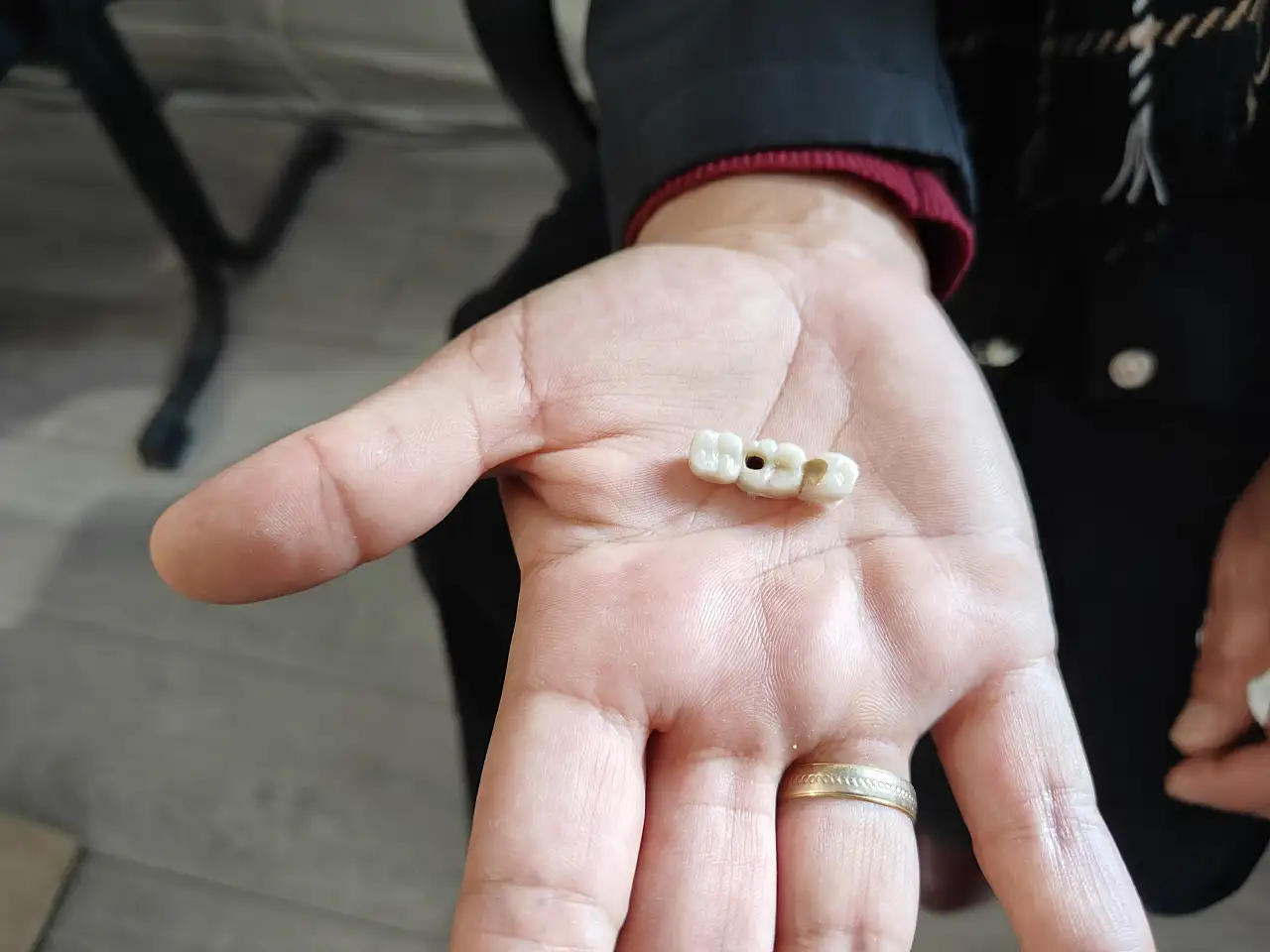 Kayseri'de implant mağduru kadın yetkililerden yardım bekliyor