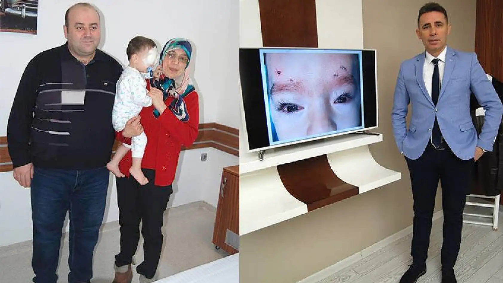 2 Yaşındaki çocuğa dünyada ilk göz nakil operasyonu!