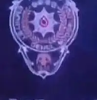 Flaş! Kayseri'de 67 masaj salonundan 42'si mühürlendi: Aralarında fuhuş yaptıran da var…