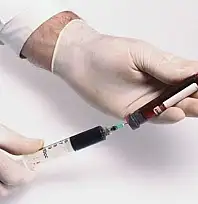 'Hepatit, bir halk sağlığı sorunudur!'