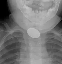 Kayseri'de dakikalarla yarıştılar: 15 aylık bebek...