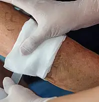 Kayseri'de yara tedavisinde çığır açmaya hazırlanıyor! Projesi destek almaya hak kazandı