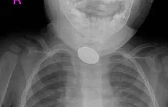 Kayseri'de dakikalarla yarıştılar: 15 aylık bebek...