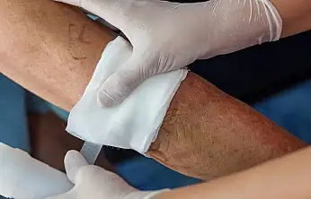 Kayseri'de yara tedavisinde çığır açmaya hazırlanıyor! Projesi destek almaya hak kazandı