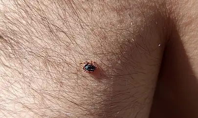 Kayseri'de 4 can almıştı! Kene bir ilçede daha görüldü