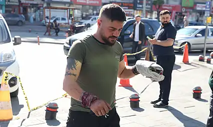 Kayseri'de manzara şaşırtamadı! Acemi kasaplar hastanelik oldu