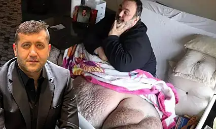 Tedavisi için 12 milyon TL gereken Kayserili için Baki Ersoy harekete geçti!