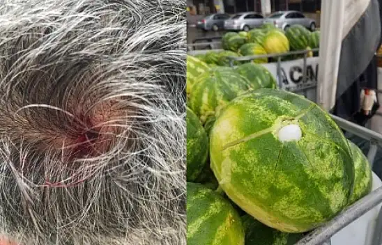 Dolu vatandaşın kafasını yardı!