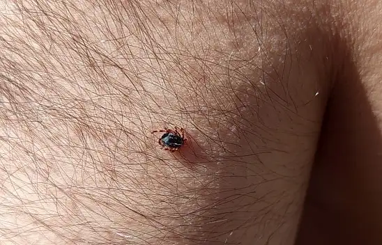 Kayseri'de 4 can almıştı! Kene bir ilçede daha görüldü