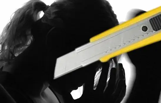 Kendisini maket bıçağı ile kesen eski eşini affetmedi