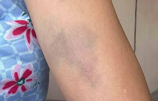 Sokak köpeklerini besleyen aileye saldırı