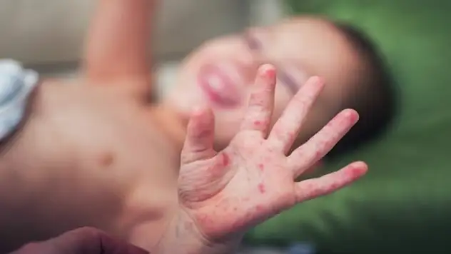 Çocuğu olan aileleri uyardı! Endişe oluşturan o değer, birçok durumda yüksek çıkabiliyor