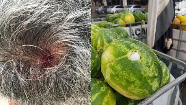 Dolu vatandaşın kafasını yardı!