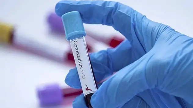 Flaş! 3 belediye çalışanı Coronavirüs'e yakalandı