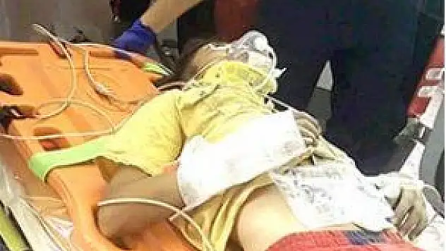 1.KATTAN DÜŞEN ÇOCUK YARALANDI