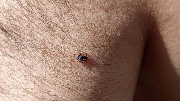 Kayseri'de 4 can almıştı! Kene bir ilçede daha görüldü