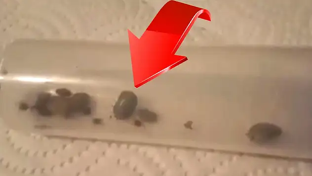 Kayseri'de 4 kişi öldü! Kenelerle ilgili şok iddia! Çoğalmasının nedeni bu mu?