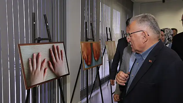 Kayseri'de fotoğraflarla romatizmaya dikkat çekildi