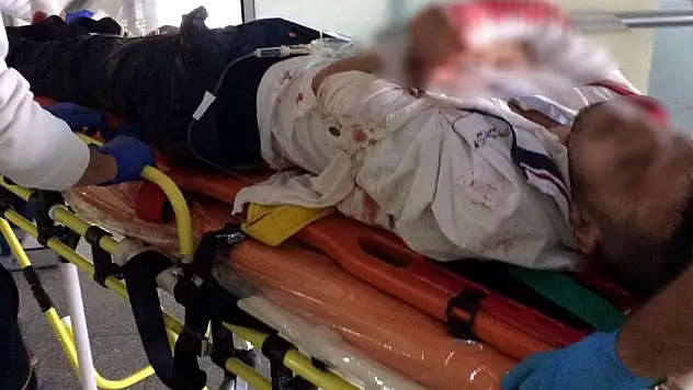 Kayseri'de silahlı kavga: 1 yaralı