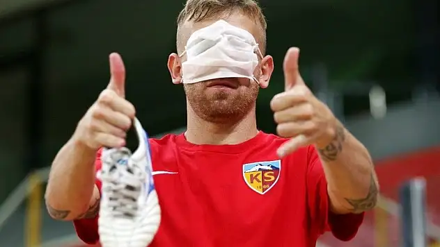 Kayserispor'da kötü haber!