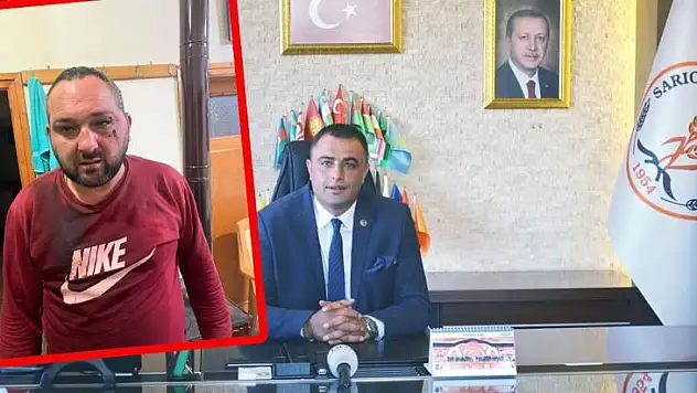 Muhtar'ın,  'Başkan adam tutarak beni darp etti' iddiası ortalığı karıştırdı!