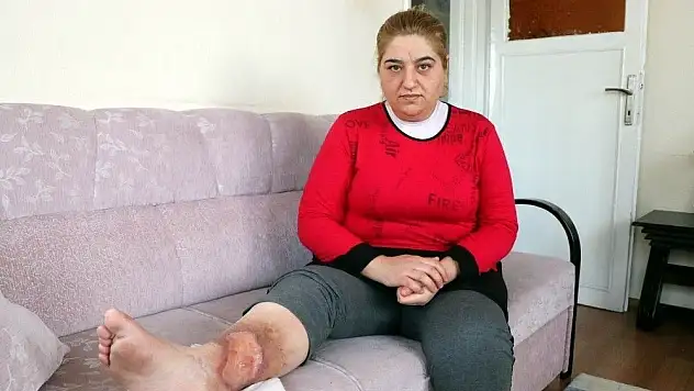 Bacaklarının kesilmemesi için 60 bin TL'ye ihtiyacı var