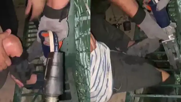 Sokakta oyun oynarken bacağı mazgala girdi!