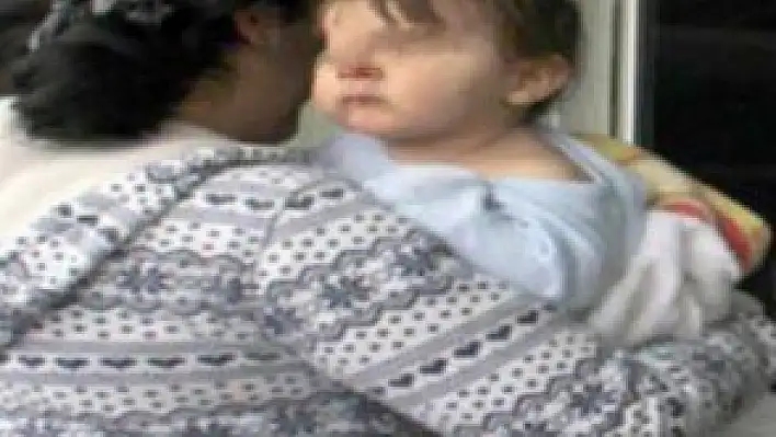 BEŞİKTEN DÜŞEN 8 AYLIK BEBEK YARALANDI