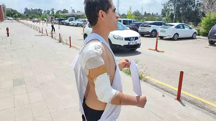 Askerden izine geldi kurt köpeğin saldırısına uğradı