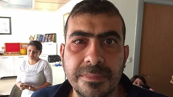 Iraklı hasta şifayı Doktoröz Göz'de buldu
