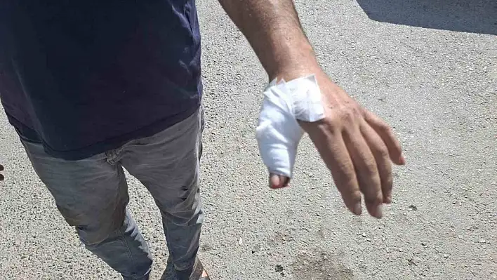 Kahramanmaraş'ta acemi kasaplar hastaneye koştu