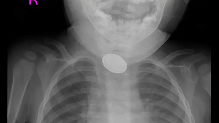 Kayseri'de dakikalarla yarıştılar: 15 aylık bebek...