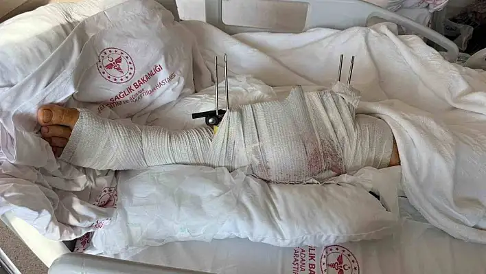 Muhtar, eski damadını vurdu