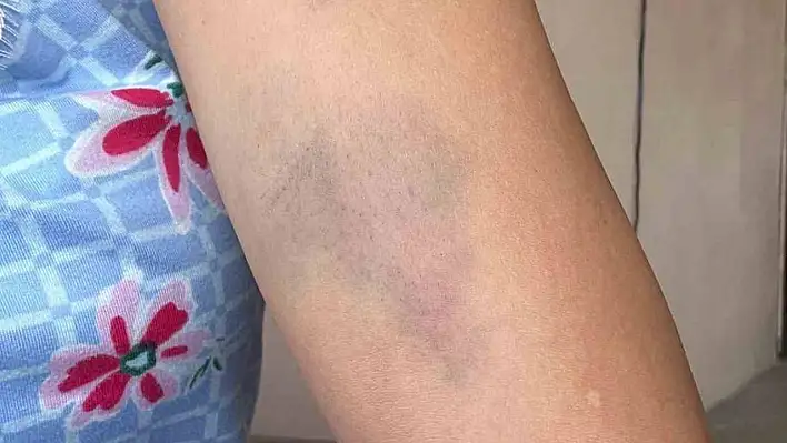 Sokak köpeklerini besleyen aileye saldırı
