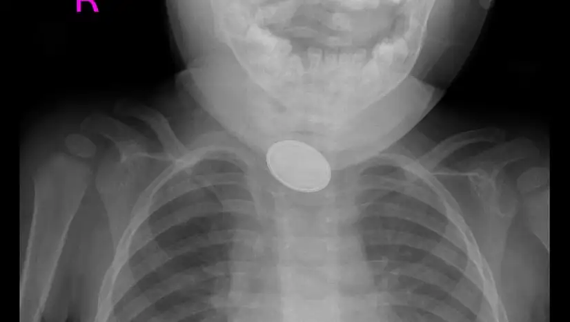 Kayseri'de dakikalarla yarıştılar: 15 aylık bebek...