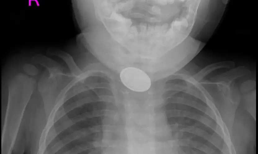 Kayseri'de dakikalarla yarıştılar: 15 aylık bebek...