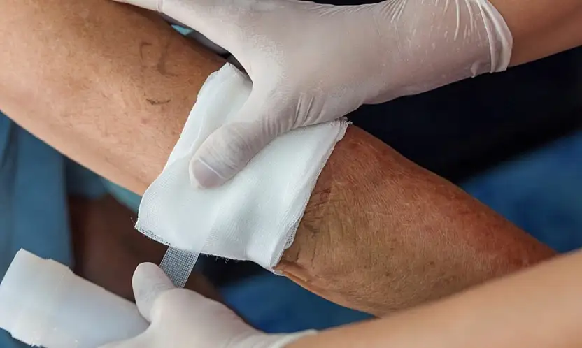 Kayseri'de yara tedavisinde çığır açmaya hazırlanıyor! Projesi destek almaya hak kazandı