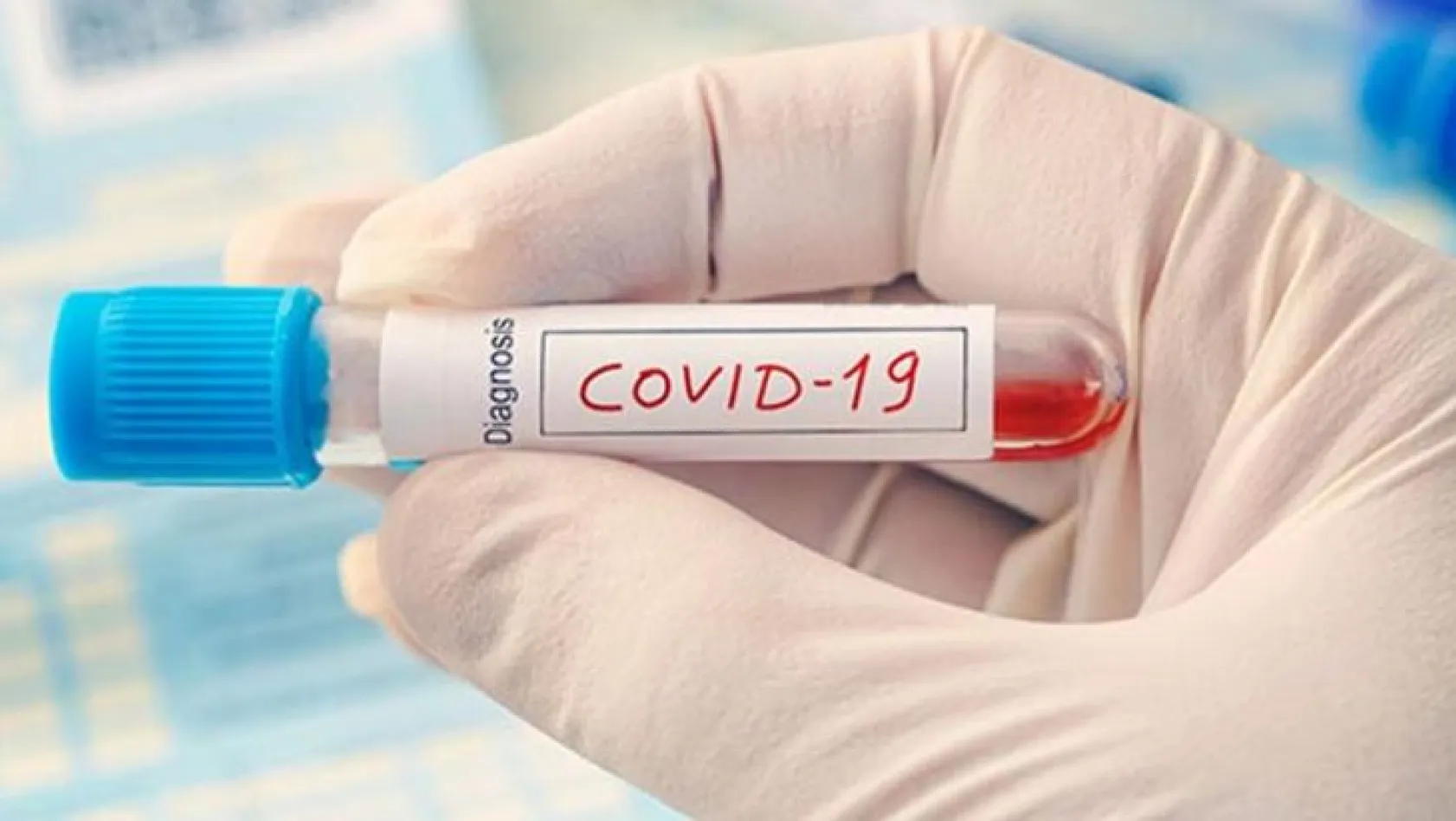 Korkutan Koronavirüs uyarısı: Daha tehlikeli olabilir...