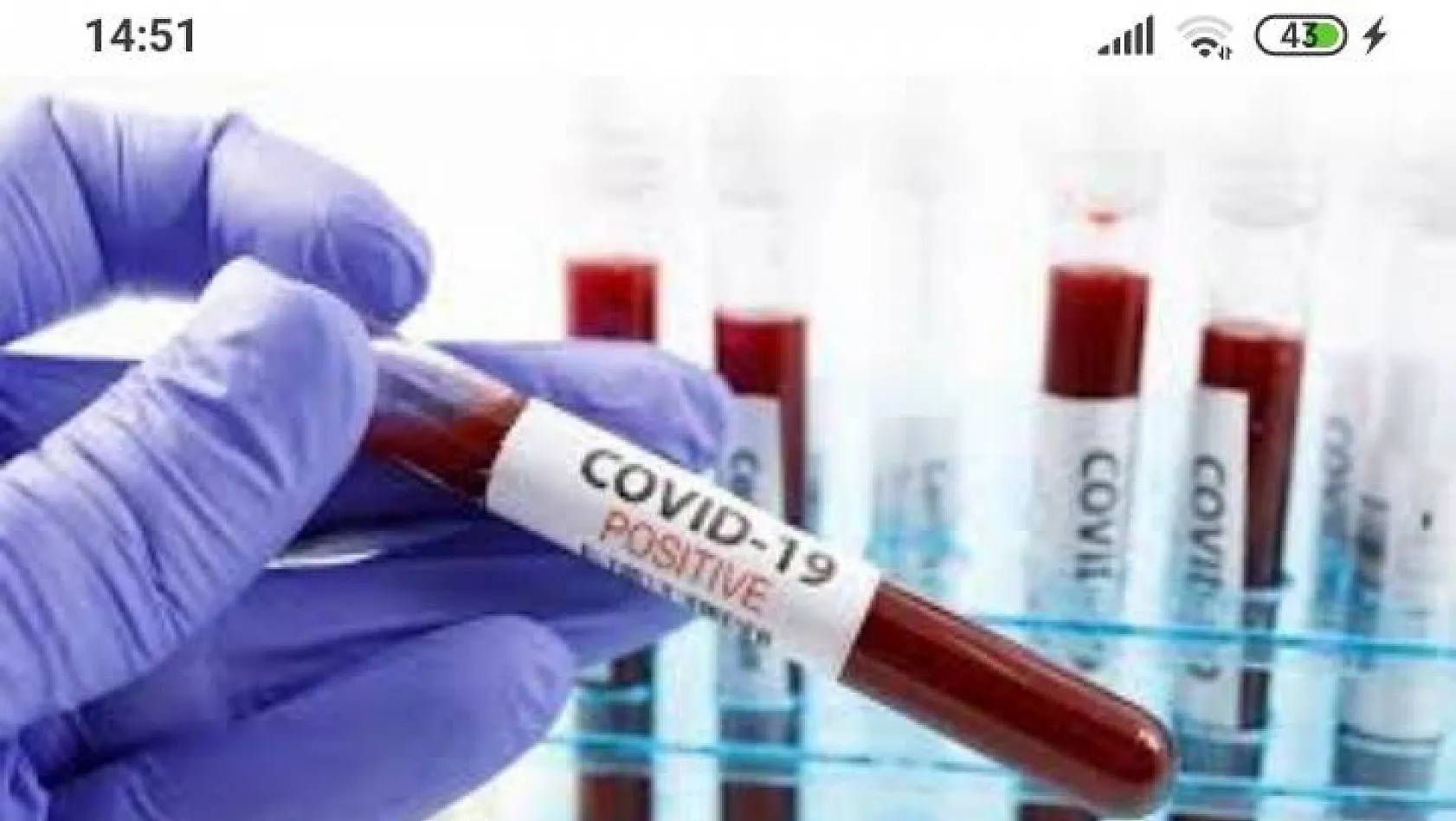 ERÜ'de Hayvanlar Üzerinde Covid-19 Aşısı denemelerine başlandı