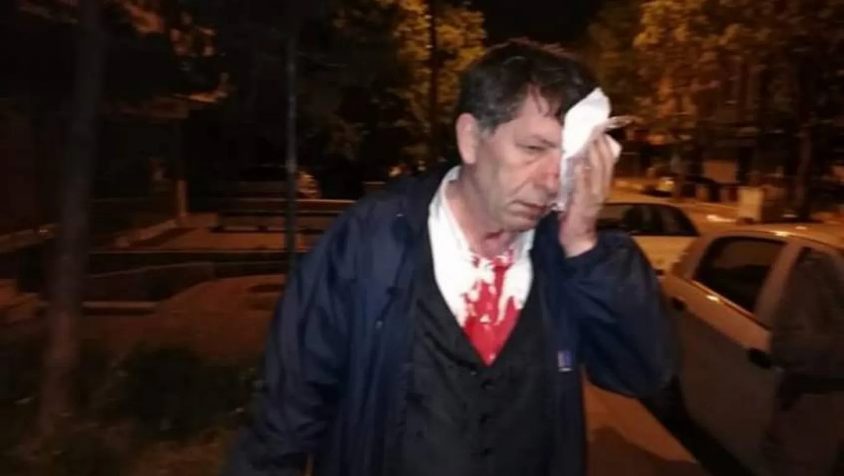 Flaş Gelişme....Kayserili Gazeteci Demirağ'ı darp eden 6 kişi yakalandı!